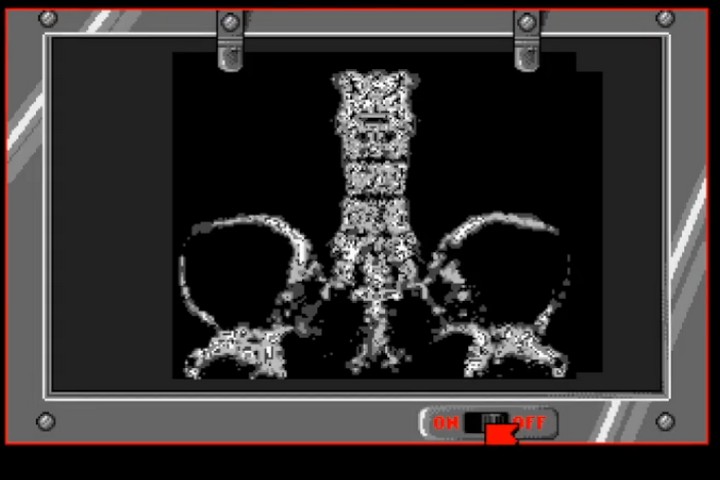 Life & Death XRay